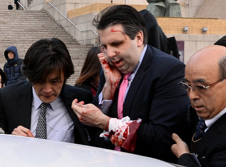 US Ambassador Mark Lippert Attacked In South Korea